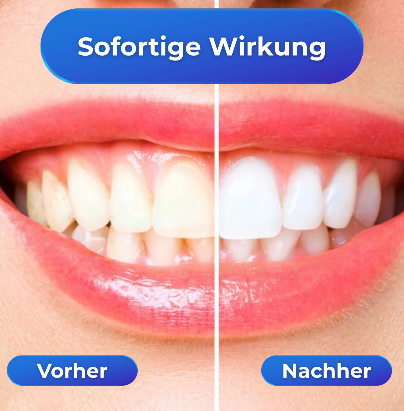 WhiteRush - strahlend weiße Zähne in Sekundenschnelle!