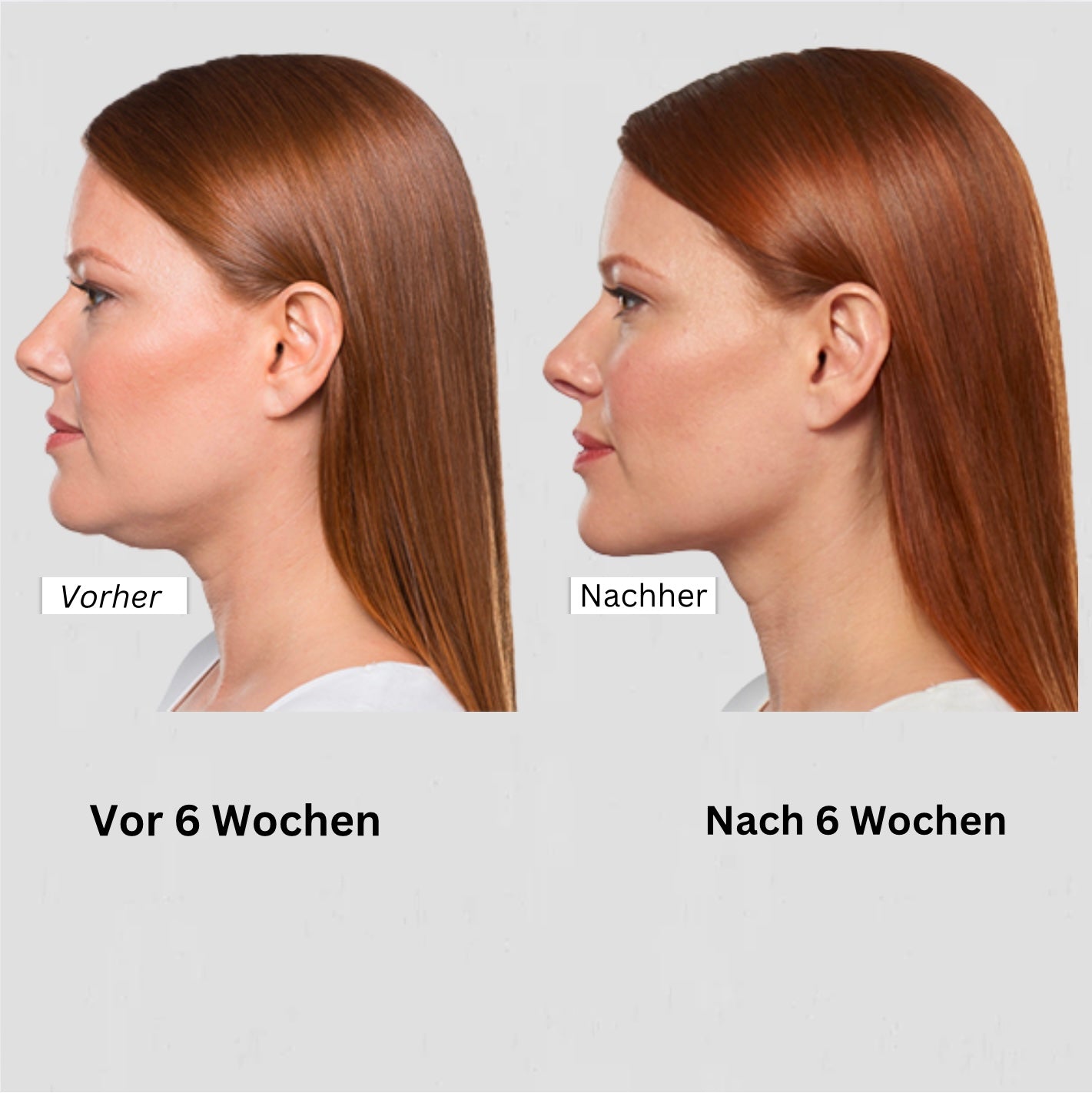 SkinVital - Das Original