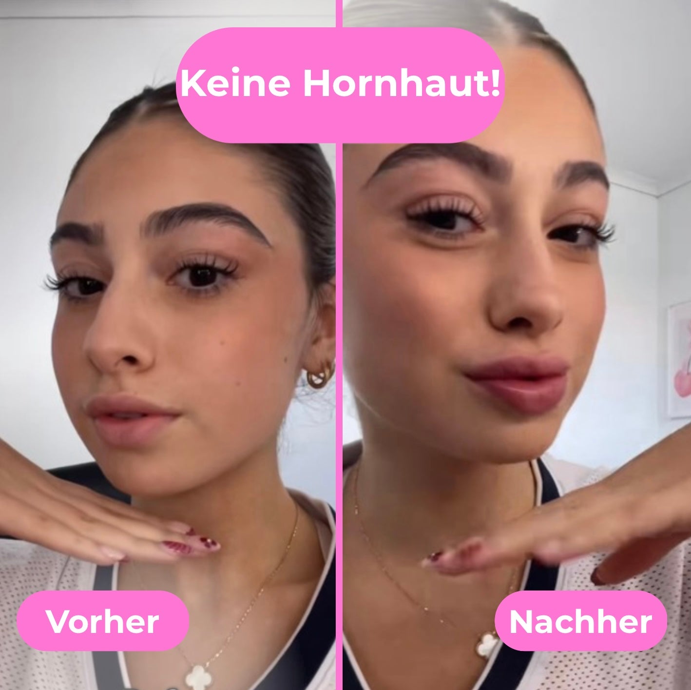 EasyPlump - Dein Lippenfüller für zuhause