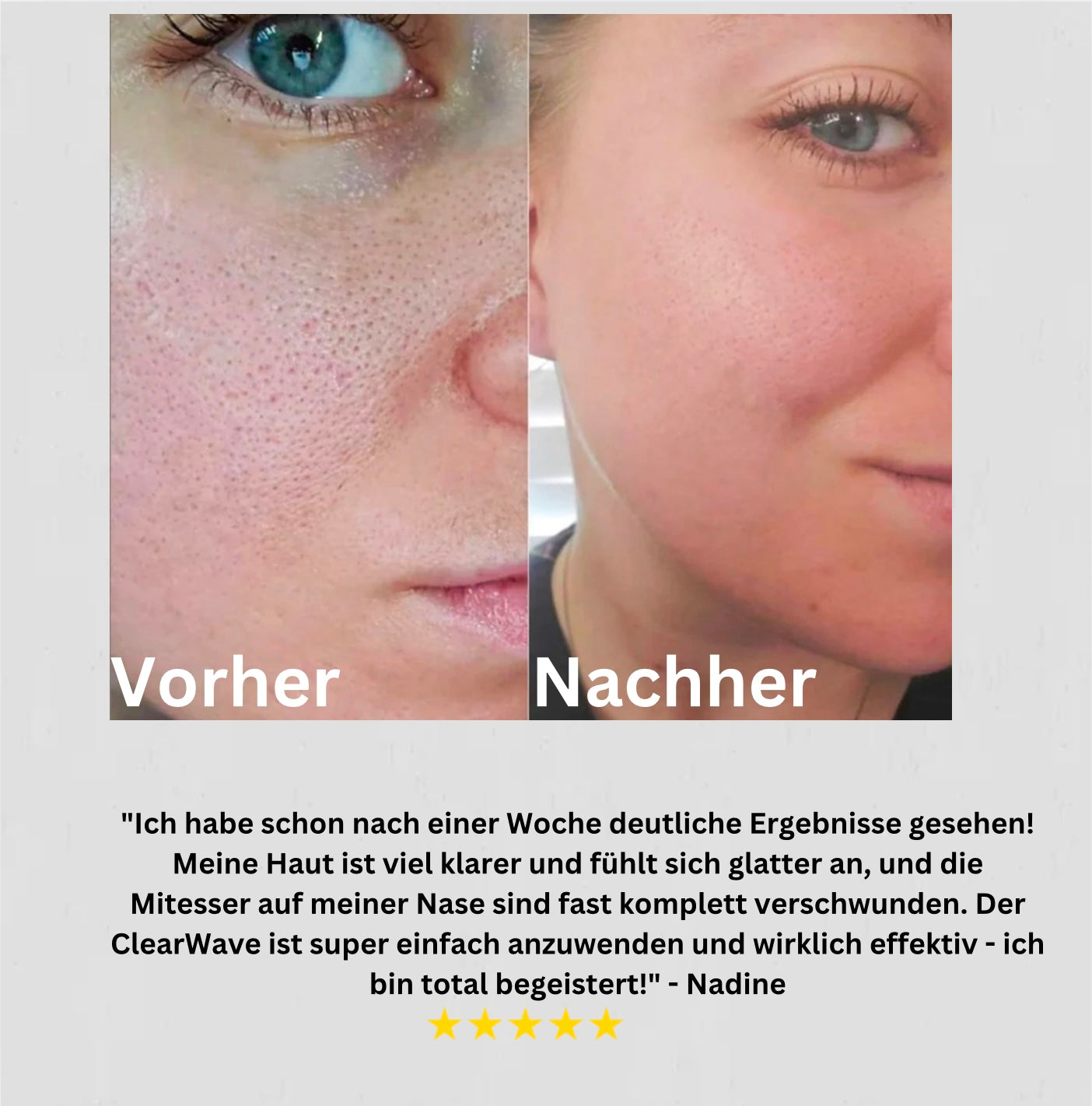 ClearWave - Anti Unreinheiten Set