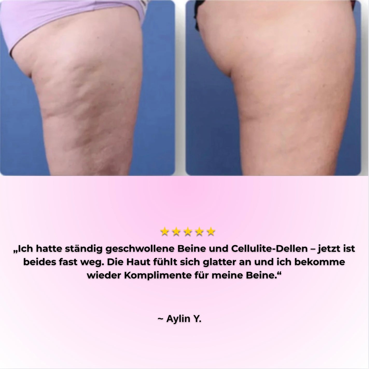 VelureLift Pro - Deine Waffe gegen Cellulite
