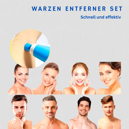 WartFree - Dein perfektes Set um deine Warzen Zuhause zu behandeln