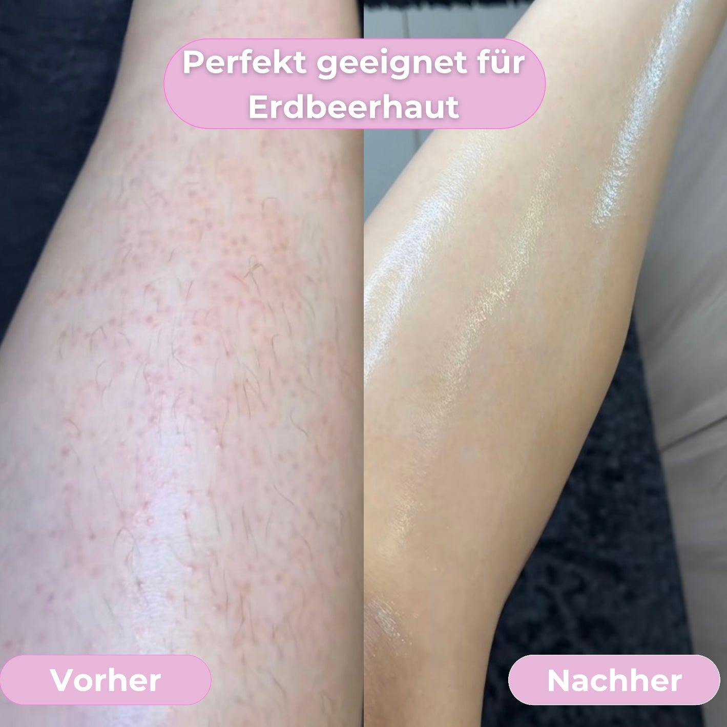 Velure Pro - Für ein sichtbar glattes Hautgefühl