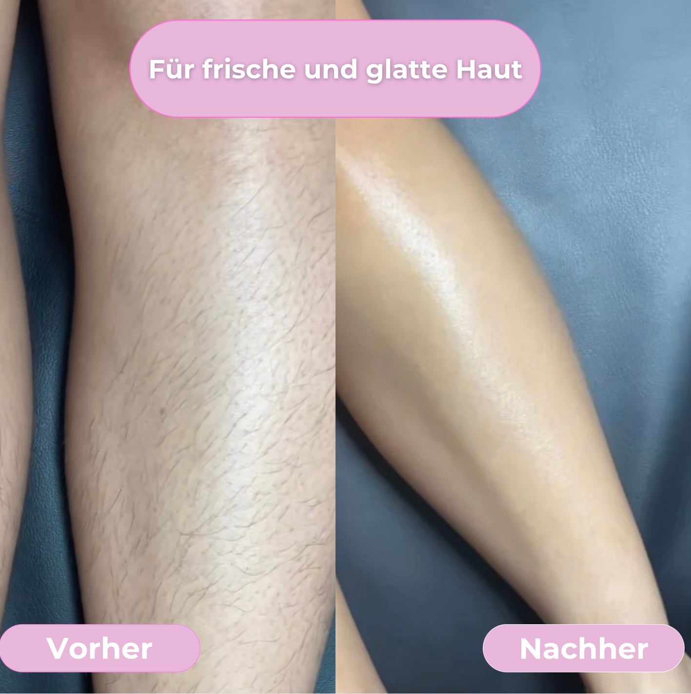 Velure Pro - Für ein sichtbar glattes Hautgefühl