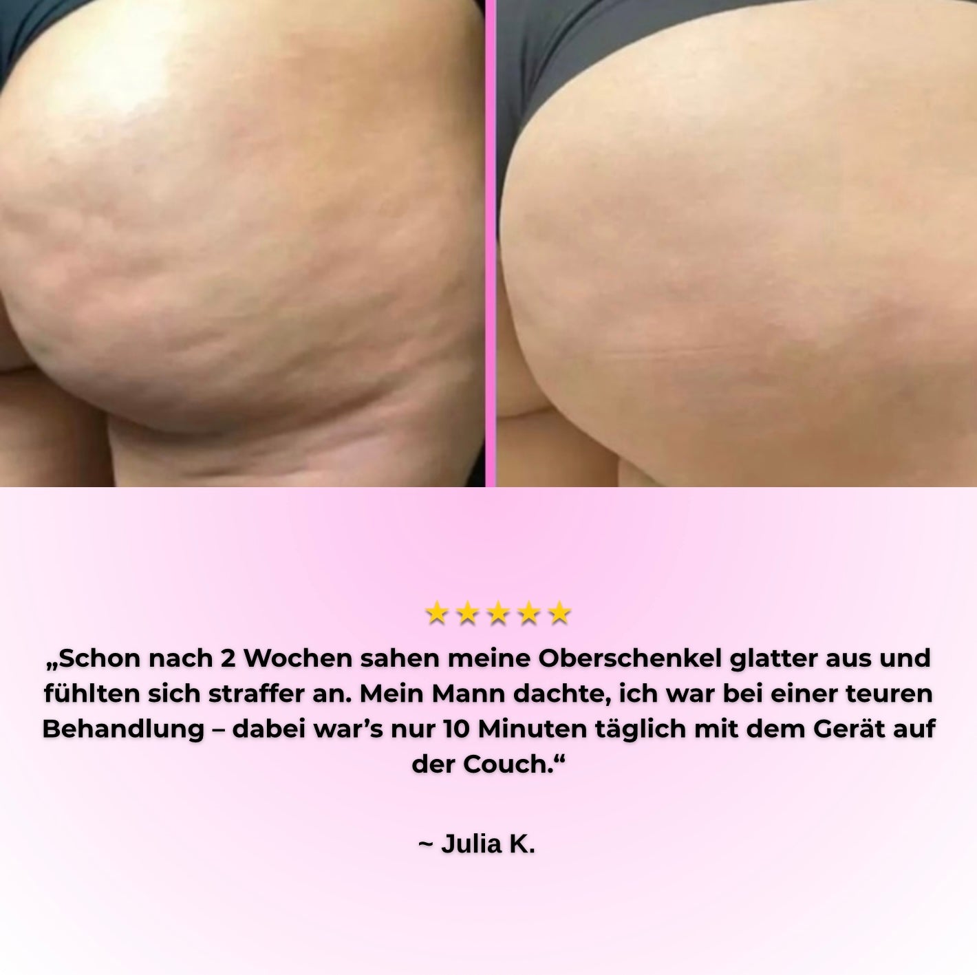 VelureLift Pro - Deine Waffe gegen Cellulite