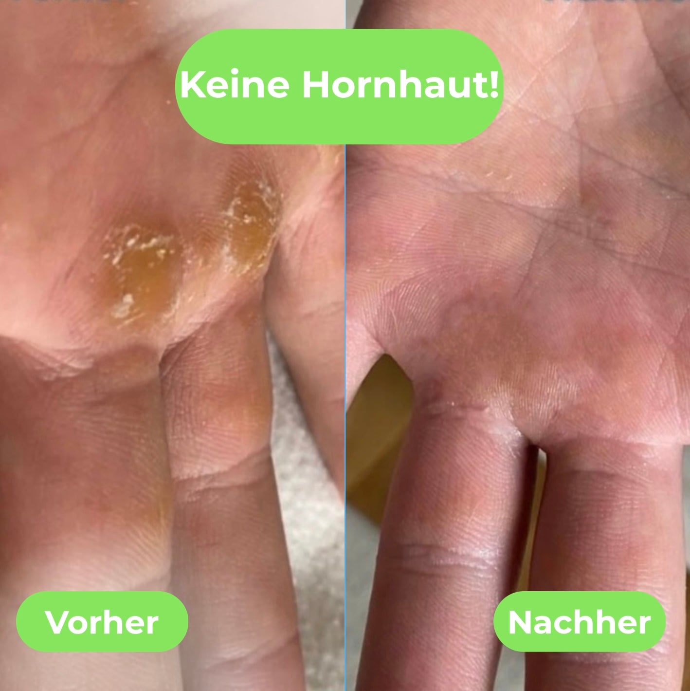 FlexGrips - Ultimativer Booster beim Sport