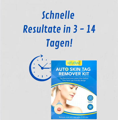 WartFree - Dein perfektes Set um deine Warzen Zuhause zu behandeln
