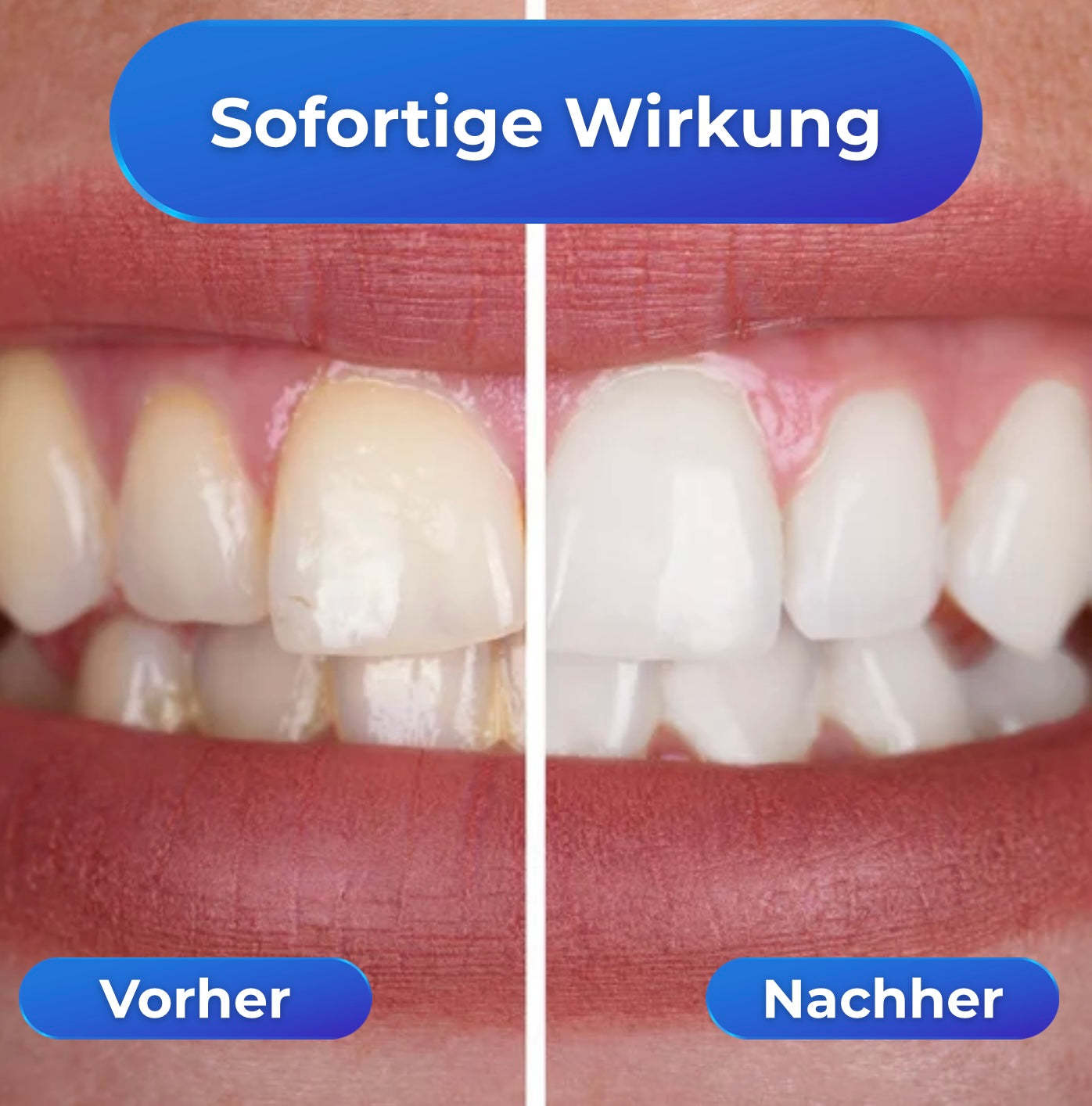 WhiteRush - strahlend weiße Zähne in Sekundenschnelle!