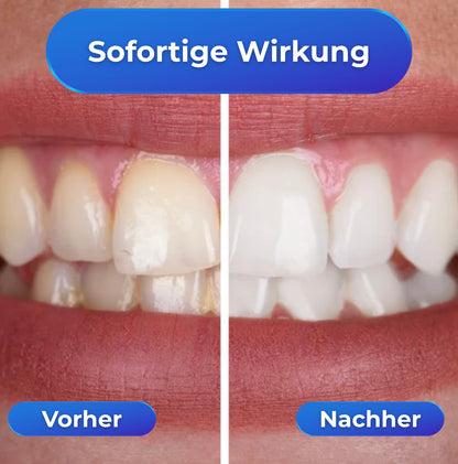 WhiteRush - strahlend weiße Zähne in Sekundenschnelle!