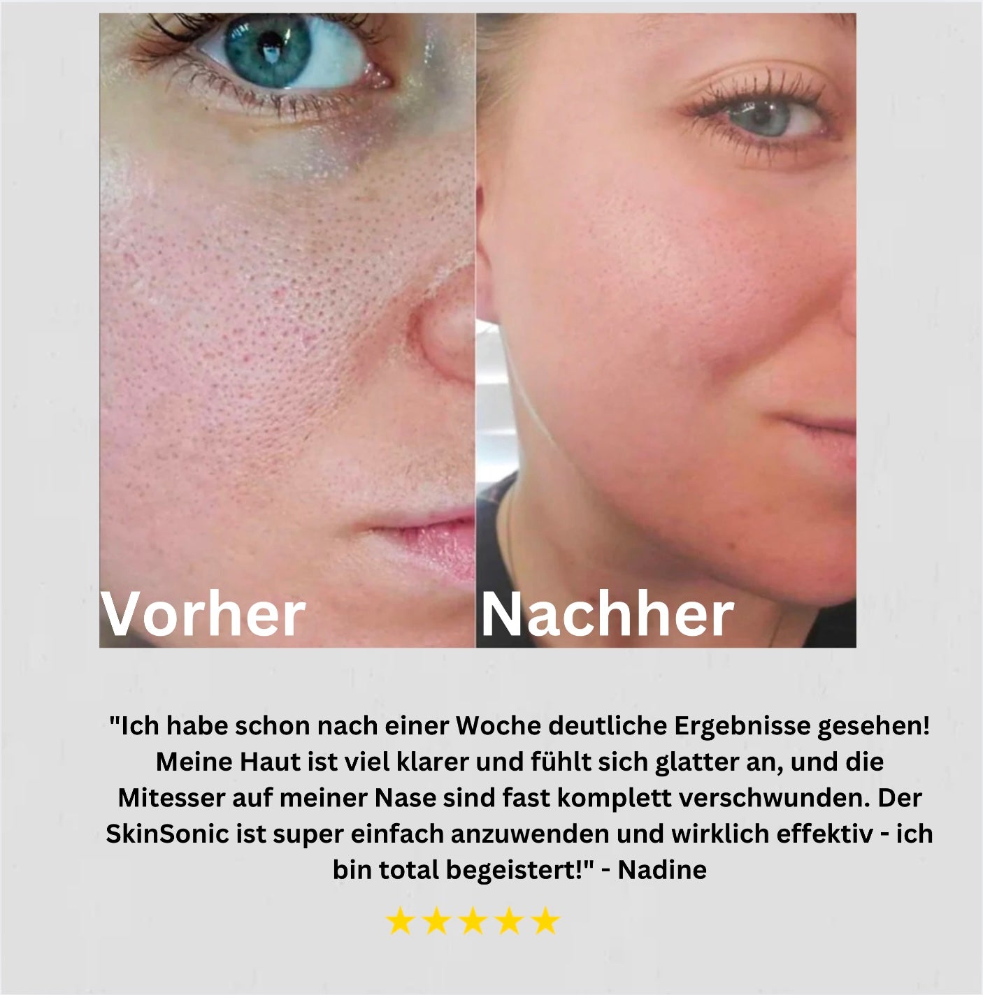 SkinSonic 360 - Gesichtspeeling mit integrierter Massagefunktion!